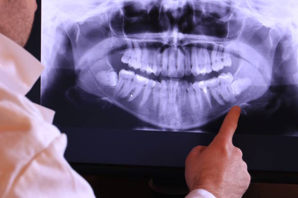 Best Emergency Treatment for Toothache in Mbrian Park, CA